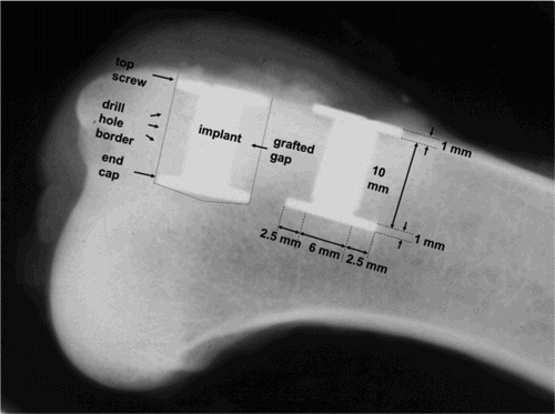 Figure 2. Radiograph of proximal humerus with 2 implants taken after specimen retrieval at 4 weeks.