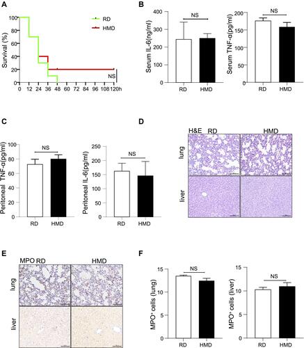 Figure 3 Methyl diet does not significantly increase mortality and inflammation in the E.coli-induced septic model. (A) Survival curve of two groups of mice after receiving 1×108 E.coli-induced sepsis modeling (n=10/group). (B, C) The levels of IL-6 and TNF-α (B) in serum and peritoneal lavage fluid (C) were detected 24h after E.coli treatment (1×107) in two groups of mice (n=4/group). (D, E) Representative lung and liver images of H&E and MPO staining of E.coli-treated (1×107) two groups of mice (200×). (F) The statistical quantification of MPO staining. The data are shown as means ± SEM.