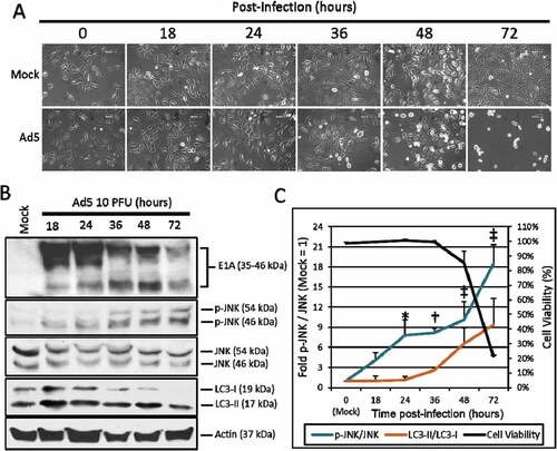 Figure 1. The effect of Ad5 upon JNK phosphorylation. A549 cells were mock treated or infected with Ad5 at 10 PFU/cell and then observed from 0 to 72 h post-infection. (a) A549 cell morphology following mock or Ad5 treatment was photographed at the indicated time-points. Mock treated cells were non-infected, while only Ad5 treated A549 cells displayed CPE. Pictures were taken using an inverted microscope at 200x total magnification. 600 µm scale bar is located in the top right corner. (b) A549 cell lysates were treated and harvested at the time-points indicated and observed for protein production via Western blot analysis. (c) These Western blot data were quantified via densitometric analysis using Gel-pro analyzer 4.0 software and these IOD values were normalized to actin. These values were then converted to fold changes by dividing the values by the values for mock treated cells. Cell viability was determined by crystal violet staining and plotted on the secondary y-axis. Results are expressed as the average of 3 experiments plus or minus the standard deviation. Statistical analysis was performed using one-way ANOVA by Dunnett’s test for multiple comparisons relative to the mock control (1 fold). * indicates p-value < 0.05, † indicates p-value < 0.01, ‡ indicates p-value < 0.001.