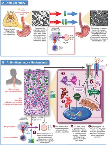 Figure 3 Proposed mechanisms of PPI efficacy for EoE. (A) Anti-Secretory Mechanism: Hypothesizes that the integrity of the esophageal epithelium is compromised by exposure to gastric acid leading to ingress of antigens and activation of an immune response. Acid suppression by PPIs allows the esophageal epithelium to heal facilitating resolution of inflammation. (B) Anti-Inflammatory Mechanisms: 1.) PPIs block expression of cell surface adhesion molecules, inhibiting migration of inflammatory cells to the esophageal epithelium; 2.) PPIs block STAT6 mediated expression of eotaxin-3 reducing recruitment of eosinophils to the esophageal epithelium; 3.) PPIs can stimulate the aryl hydrocarbon receptor normalizing expression of genes involved in barrier function including, filaggrin, loricrin, and involucrin through inhibition of the IL-4/IL-13-STAT6 pathway; 4.) PPIs can inhibit the activity of ATP12A, the non-gastric P2-type H+, K+-ATPase. IL-4 mediated induction of eotaxin-3 secretion is sensitive to inhibition of ATP12A.