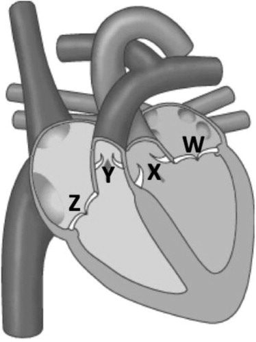   image modified from https://en.wikipedia.org/wiki/Heart_valve#/media/File:Latidos.gif