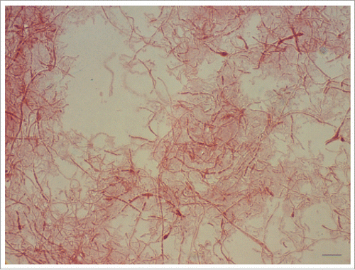 Figure 2. Gram-negative, pleomorphic cells of a 6-day-old culture of Streptobacillus moniliformis DSM 12112T are arranged in chains and clumps and display irregular, lateral bulbar swellings, that resemble a ‘string of beads’ or a necklace – the translation of the Latin word moniliformis. The 0.1–0.7 × 1–5 µm sized bacteria tend to pleomorphism and might form up to 150 µm unbranched filaments. Oil immersion, ×1000 magnification. Bar, 5 µm.