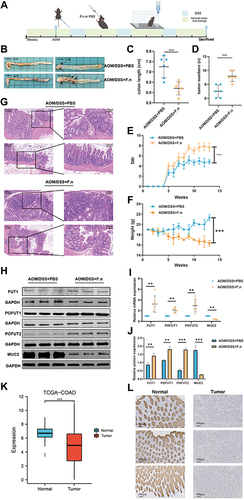 Figure 5 The influence of F.n on COAD and FUTs expression. (A) Flowchart depicting the experimental procedure. (B) Mouse colon specimen, (C–F) Comparison of the colon length (C), tumor numbers (D), DAI score (E) and weight (F) of CAC mice treated with F.n or PBS. (G) HE staining of the colon tissues in CAC mice treated with F.n or PBS. (H) Comparison of the FUT1, POFUT1, POFUT2 and MUC2 expression by Western blot. (I) Comparison of the FUT1, POFUT1, POFUT2 and MUC2 expression by RT-qPCR. (J) Quantification of Figure 5H. (K) Differential expression of MUC2 between COAD tissues and normal colon tissues in the TCGA cohort. (L) Differential expression of MUC2 in COAD tissues and normal colon tissues by immunohistochemistry. (**P<0.01, ***P<0.001, ns: P>0.05).