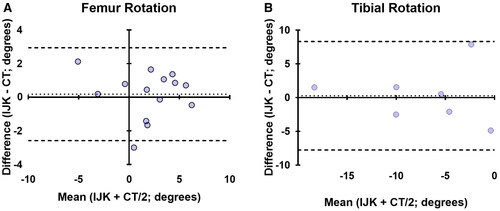 Figure 4. Bland-Altman plots showing agreement in the transverse plane cuts guided by Intellijoint KNEE (IJK) including femur rotation (A) and tibial rotation (B). the average difference between the two measurements is compared with the average of the two measurements. 100% of paired measurements were within the statistical limits (±1.96 × SD, dashed lines) for acceptable agreement in tibial rotation and 93% of measurements were in agreement for femur rotation. The femoral rotation values combine data referenced from both whiteside’s line and the PCA (n = 14), while tibial values are derived from the PCL-MTT axis only (n = 7).