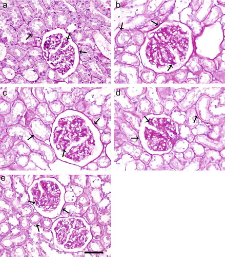 FIGURE 1. PAS staining of kidney sections of control (a), diabetic untreated (b), diabetic treated with Irb (c), diabetic treated with ALA (d), and diabetic treated with Irb+ALA (e) rats. Increased mesangial matrix, thickened CBMs, TBMs, and GBMs are present in the glomerulus of diabetic untreated rats as compared with the control and diabetic treated rats (arrows: PAS positive area, PAS; scale bar, 50 μm).