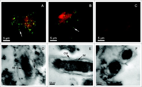 Figure 2. Microscopy analysis of YbgF and TolC in R. rickettsii cells. Rickettsia rickettsii were cultured in Vero cells and incubated with antibodies against rYbgF (A) or rTolC (B), or with naïve (C) serum. Secondary antibodies conjugated to fluorescein isothiocyanate (FITC) were then applied. The white arrows indicate YbgF or TolC in R. rickettsii cells. TEM analysis of R. rickettsii in Vero cells involved staining with antibodies against rYbgF (D), rTolC (E), or with naïve (F) serum. A goat anti-mouse IgG labeled with colloidal gold particles was then added to samples. The black arrows indicate the locations of YbgF or TolC in the inner membrane (IM) and outer membrane (OM) of R. rickettsii cells.
