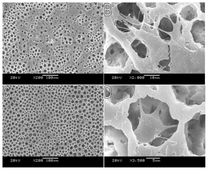 Figure 6 SEM photographs showing morphology of NIH3T3 cells cultured on PLA scaffold. A) Cells cultured for 3 days, 200×; B) Cells cultured for 3 days, 2000×; C) Cells cultured for 12 h, 200×; D) Cells cultured for 12 h, 3500×.Abbreviations: PLA, poly(d,l-lactic acid); SEM, scanning electron microscope.