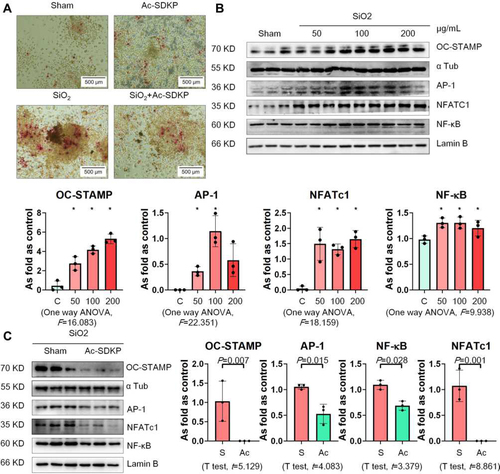 Figure 6 Ac-SDKP reduces TRAP-positive cells and RANKL signaling in RAW 264.7 cells treated with SiO2. (A) TRAP staining, Bar= 500 μm; (B) Levels of OC-STAMP, AP-1, NFATc1, and NF-κB in RAW 264.7 cells treated with 50, 100, and 200 µg/mL silica measured by Western blotting. *Compared with control group, P<0.05. Data are presented as the mean ± SD. n = 3 per group. (C) Protein expression of OC-STAMP, AP-1, NFATc1, and NF-κB in RAW 264.7 cells treated with SiO2 and Ac-SDKP or not. Data are presented as the mean ± SD. n = 3 per group.