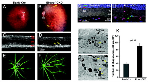 Figure 4. RPE degeneration present by 4 mo of age. (A, B) Fundus photograph shows the significant RPE atrophy present in the Rb1cc1-CKO mice, as compared to littermate controls. ON signifies the optic nerve. Yellow and red arrows point to representative foci of RPE atrophy and clumping, respectively. (C, D) OCT imaging shows the increased granularity of the RPE reflectance and the presence of hyperreflective foci located above the RPE (yellow arrows). (E, F) Fluorescein angiography showed a normal retinal vasculature in both groups of mice. (G, H) Immunostaining for the Cre-recombinase (red) showed that there was no RPE degeneration in the Best1-Cre control retinas, but only in the Rb1cc1-CKO retinas where there was Cre expression. Staining for CD68 showed infiltration of macrophages into the areas of degenerating RPE. (I–K) Transmission electron microscopy showed that there were significantly more unprocessed phagosomes (yellow arrows) present in the RPE of the Rb1cc1-CKO mouse, as compared to littermate controls. IS, inner segment; OCT, optical coherence tomography; ONL, outer nuclear layer; OS, outer segment; RPE, retinal pigment epithelium.