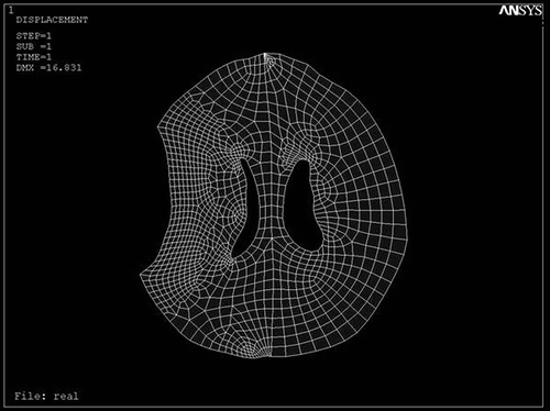 Figure 4. Nodal solution of the modeled brain with p = 1.25 kPa in ANSYS 8.0.