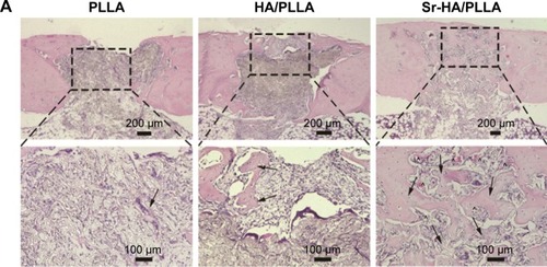 Figure 7 The changes in bone microstructure after implantation of different porous scaffolds.Notes: (A) Microscopic images of H&E-stained tissue sections of femur defects after 5 weeks’ implantation. (B) Masson-stained tissue sections of femur defects after 5 weeks’ implantation (black arrow: new bone, ^: blood vessel, and red arrow: collagen).Abbreviations: H&E, hematoxylin and eosin; PLLA, poly(l-lactic acid); HA/PLLA, hydroxyapatite on porous poly(l-lactic acid); Sr-HA/PLLA, strontium-doped hydroxyapatite on porous poly(l-lactic acid).