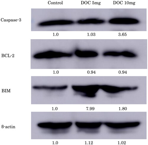 Figure 3. DOC increases caspase-3 and BIM expression but not BCL-2 expression in mice. Representative images showing western blotting of whole ovary proteins for caspase-3, BCL-2, and BIM expression in the control, DOC-5 (5 mg/kg DOC) and DOC-10 (10 mg/kg DOC) groups. Six ovaries were analysed for each treatment group. The data presented were normalised against those for the PBS-treated group.