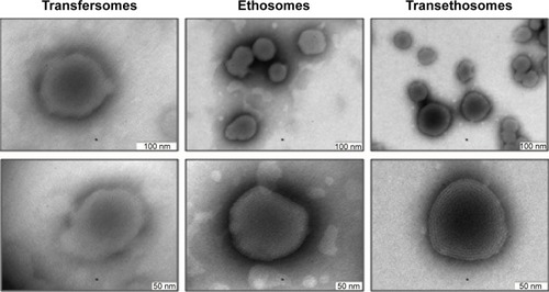 Figure 4 Microscopic appearance of ultradeformable vesicle formulations obtained by transmission electron microscopy.