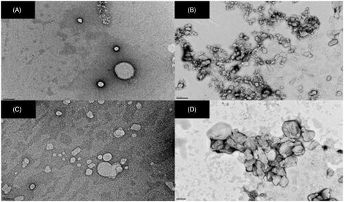 Figure 2. Transmission electron photomicrographs of (A) SLNs, (B) SLN-RIF, (C) M-SLNs and (D) M-SLN-RIF (n = 3). (Scale bar: 200 nm). M-SLN-RIF: rifampicin-loaded mannosylated solid lipid nanoparticles; M-SLNs: mannosylated solid lipid nanoparticles; SLN RIF: rifampicin-loaded solid lipid nanoparticles; SLNs: solid lipid nanoparticles.
