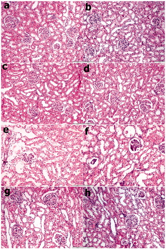 Figure 1. Renal tissue H & E staining images: (a) Control group, (b) PBS group, (c) SPC2 group, (d) SPC10 group, (e) Contrast group, (f) Contrast + PBS, (g) Contrast + SPC2 group, and (h) Contrast + SPC10 group. a, b, c, and d figures, the histology of renal tissues was normal in appearance. However, contrast group (e) have been necrotic cells, cytoplasmic vacuole, and tubule injuries were reasonably higher in the renal tissues. Contrast + SPC2 and SPC10 groups’ tubule injuries and necrotic cells were highly decreased in the renal tissues compared with contrast and contrast + PBS groups (Hematoxylin–Eosin stain, magnifications: ×200).