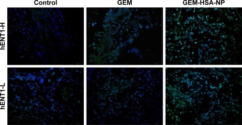 Figure 6 The merged TUNEL staining indicated the degree of apoptosis in tumor tissues after various treatments in the hENT1-H and hENT1-L groups.Notes: Green fluorescence represented apoptotic cells, and DAPI (blue) was used to stain nuclei.Abbreviations: GEM, gemcitabine; GEM-HSA-NP, gemcitabine-loaded human serum albumin nanoparticle; TUNEL, terminal deoxynucleotidyl transferase dUTP nick end labeling; hENT1-H, high hENT1 expression; hENT1-L, low hENT1 expression.