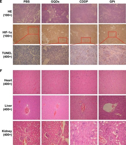 Figure 10 GPt inhibits tumor growth in vivo. (A) Average body weight of mice in each experimental group. (B) Tumor volumes of mice after the injection of PBS, GQDs, CDDP, and GPt, respectively. (C) Distribution of Pt between tumor and different organs detected by ICP-MS. (D) The graphical display of HSC3 xenograft mice after being injected with PBS (I), GQDs (II), CDDP (III), and GPt (IV), respectively. (E) HE staining (100×), IHC staining of HIF-1α protein (100×), and TUNEL (400×) of tumor tissues in groups treated with PBS, GQDs, CDDP, and GPt. (F) Representative HE staining images of major organs including heart, liver, and kidney collected from HSC3 tumor bearing mice after treatment with PBS, GQDs, CDDP, and GPt, respectively. *p<0.05; **p<0.01; ***p<0.005.Abbreviations: PBS, phosphate-buffered saline; HE, hematoxylin and eosin; IHC, immunohistochemistry; HIF-1α, hypoxia inducible factor-1α; ICP-MS, inductively coupled plasma-mass spectrometry; CDDP, cisdiamminedichloroplatinum (II); GQDs, graphene quantum dots; TUNEL, terminal deoxynucleotidyl transferase-mediated dUTP-biotin nick end labeling assay; GPt, polyethylene glycol-GQDs-Pt.