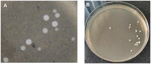Figure 1 India ink preparation demonstrating encapsulated yeast cells (A) and creamy growth of yeasts on Sabouraud agar of approximately 10 colony forming units/mL of cerebrospinal fluid (B).