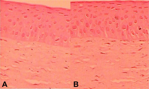 Figure 11 Comparative histopathology image of (A). optimized gentamycin chitosan nanoparticles sol-gel (GTM-CHNPopt sol -gel, NSG5) and (B). control (0.9% NaCl) - treated cornea. 
