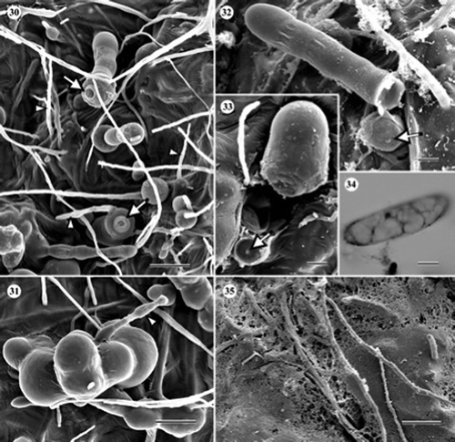 Figures 30–35. Scanning electron and light micrographs of Cryptosporiopsis melanigena (ex-type, UAMH 10731, CBS 898.97) on CMA overlaid with cellophane membrane after 3 months at 22 °C. (30) Variously shaped chlamydospores and setose hyphae (arrowheads). Arrows indicate secession scars. (31) Chlamydospore giving rise to a germ tube (arrowhead). (32, 33). Chlamydospores seceded by septum schizolysis. Arrows indicate septal pores at the exposed apexes of conidiogenous cells. (34) Macroconidium. (35) Cellophane being degraded by hyphae. Bars = 17 μm (Figure 30); 12 μm (Figure 31); 6 μm (Figure 32); 4 μm (Figures 33 and 34); 30 μm (Figure 35).