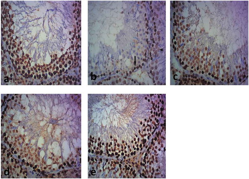 Figure 10. A photomicrograph of immunohistochemical stained sections for PCNA of testes of the different groups.