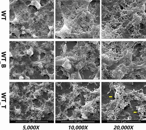 Figure 3. Scanning electron microscopy observations of the architecture of S. mutans WT, WT_B and WT_T strain biofilms. WT_T showed decreased extracellular polymeric substances in the biofilms interspersed among ‘blank’ areas (yellow arrows). Representative images are shown from at least six randomly selected positions of each sample