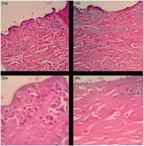 Figure 5. Histopathological evaluation of porcine cells treated with lyophilized aqueous extract of leaves of A. sellowiana and negative control at 100 and 400 times magnification. (1a) Swine epidermal cells treated with lyophilized aqueous extract of leaves of A. sellowiana at 1 mg/mL (100 times magnification). (1b) Swine epidermal cells treated with PBS buffer solution pH 7.0 (100 times magnification). (2a) Swine epidermal cells treated with lyophilized aqueous extract of leaves of A. sellowiana at 1 mg/mL (400 times magnification). (2b) Swine epidermal cells treated with lyophilized aqueous extract of leaves of A. sellowiana at 1 mg/mL (400 times magnification).