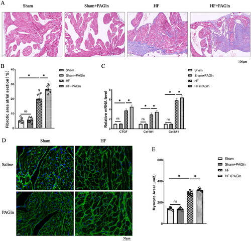 Figure 2. PAGln intervention aggravate atrial cardiomyocyte fibrosis and cardiomyocyte hypertrophy. (A) The images of Masson’s trichrome staining of the left atrium in four groups mice. (B) Statistical analysis of myocardial fibrosis area in four groups mice (n = 8). (C) the mRNA expression of CTGF, Collagen I, Collagen III was significantly increased in overpressure-induced HF mice, and PAGln intervention further promoted the expression of fibrosis marker (n = 8). (D) The images of wheat germ agglutinin (WGA) stain in the atrial myocyte area, and (E) the statistical analysis of the atrial myocyte area in overpressure-induced HF mice (n = 8). Data are expressed as mean ± SD, one-way ANOVA with Welch correction (unequal variance). *P < 0.05; ns, not statistically significant.