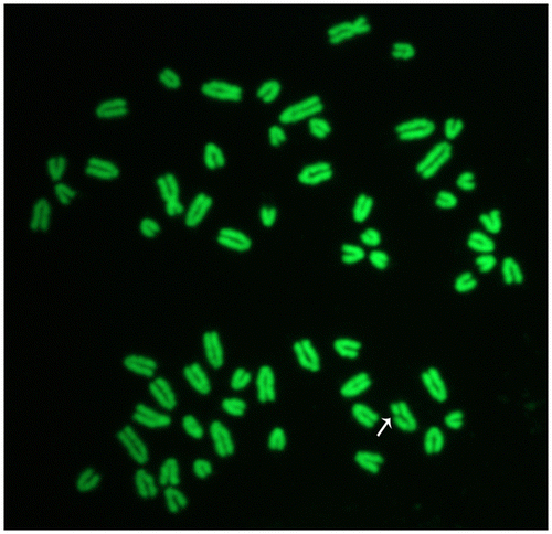 Figure 2. Female cattle metaphase plate showing a chromatid break (arrow). Slides were stained with acridine orange and later observed under a fluorescence microscope connected with a digital camera.