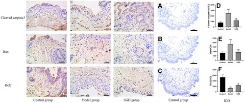 Figure 7 Immunohistochemical results of cleaved caspase-3, Bax, and Bcl2 in SO tissue (400×); a, b, and c: cleaved caspase-3 immunohistochemical results in the normal group, model group, and SGD treatment group, respectively; d, e, and f: Bax immunohistochemical results in the normal group, model group, and treatment group, respectively; g, h, and i: Bcl2 immunohistochemical results of the normal group, the model group, and the treatment group, respectively. The brown or brown cytoplasm is the expression of the corresponding positive protein (*). (A–C) The negative controls for cleaved caspase-3, Bax, and Bcl2 using control samples, respectively. (D–F) Respectively fluoresced caspase-3, Bax, and Bcl2 (IOD) in the SO tissue of rabbits in each group. The model group vs the control group, ***P ≤ 0.001. The SGD group vs the model group,##P≤0.01, ###P ≤ 0.001.