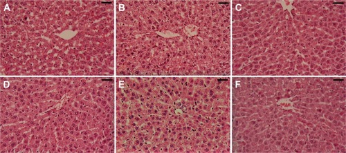 Figure 10 Histology of the liver.Notes: (A) Control group, showing normal portal triad along with normal hepatocytes with a central vein. (B) SeNP-treated group, showing normal portal triad along with normal hepatocytes with a central vein. (C) STZ group, showing hepatic vein congestion, invasion of inflammatory cells, variability in the nuclear size, and mild fat deposition. (D) STZ-SeNP-treated group, SeNPs treatment showing arranged hepatocytes. (E) STZ-Ins-treated group, insulin treatment protected the majority of hepatocytes. (F) STZ-SeNPs-Ins-treated group, SeNPs and insulin treatment showing normal portal triad along with normal hepatocytes with central vein. Sections stained with hematoxylin and eosin. Scale bar =50 μm.Abbreviations: Ins, insulin; SeNPs, selenium nanoparticles; STZ, streptozotocin.
