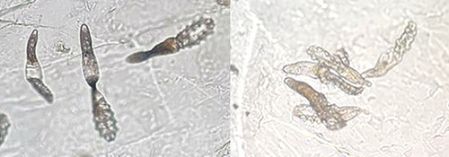 Figure 3 Mites exposed to sweet basil oil shrank, distorted, and deformed after a few minutes of death, while those exposed to ivermectin became smaller and translucent two hours later.