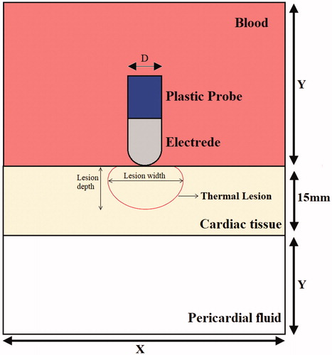 Figure 1. The geometry of computational model (not to scale).