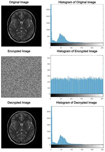 Figure 12. Results of the encrypted and decrypted brain image with histograms.