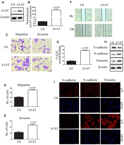 Figure 3 A1AT overexpression enhances lung cancer cell metastasis in vitro. (A, B) A1AT expression in A549 cells transfected with a vector overexpressing A1AT or a control vector (Ctl) by Western blot analysis (A) and quantitative PCR (B). (C–E) Cell migration was monitored in transwell assays and matrigel transwell assays in A1AT-overexpressing and control A549 cells (scale bar, 100 μm). Representative images (C) and quantitation (D, E) are shown. (F, G) Analysis of the effects of A1AT overexpression on cell migration in wound-healing assays (scale bar, 500 μm). Representative images (F) and quantitation (G) are shown. (H, I) Analysis of the expression of E-cadherin (epithelial marker) and vimentin and N-cadherin (mesenchymal markers) in A1AT-overexpressing and control cells by Western blotting (H) and immunofluorescence staining (I); scale bar, 50 μm.