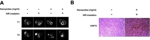 Figure 6 In vivo magnetic resonance imaging (MRI) scans and tumoral heat shock protein HSP70 expression. (A) Tumor-bearing BALB/c mice were intratumorally injected with saline or NaYF4:Yb,Er@PE3@Fe3O4 nanoprobes, followed by either near-infrared irradiation (NIR) irradiation or not. Five days later, both T1- and T2-weighted MRI scans were captured from each treatment group. (B) Immunohistochemical analysis of tumoral HSP70 expression in control mice and those receiving photothermal therapy. This experiment was repeated three times.
