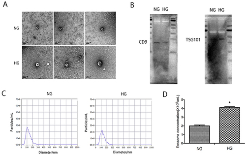 Figure 1 The identification of exosomes. HK-2 cells were cultured under normal glucose (NG) and high glucose conditions (HG; 30mmol/L glucose) for 30h respectively. (A) Representative TEM image of exosomes derived from the culture supernatant of HG group and control group. (B) Exosomal markers CD9 and TSG101 were detected by Western blot. (C) The particle size of the exosomes (nm) enriched from the culture supernatant of two groups was examined through NTA using a ZetaView_Particle Metrix instrument. (D) The concentration of exosomes from the culture supernatant of two groups. *P<0.05 vs the control group.