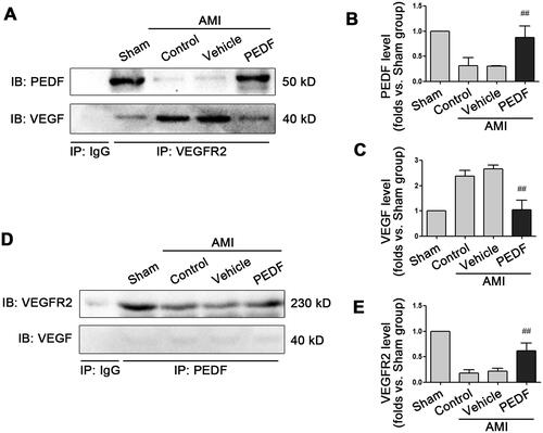 Figure 3. PEDF inhibits VEGF via binding to VEGFR2. (A) Heart tissue lysate was Co-IPed with anti-VEGFR2 antibody or rabbit IgG, and then analyzed by Western blotting with anti-PEDF and anti-VEGF antibody. Densitometry analysis of PEDF (B) and VEGF (C) levels versus the sham group. (D) Heart tissue lysate was Co-IPed with anti-PEDF antibody or rabbit IgG, and then analyzed by Western blotting with anti-VEGFR2 and anti-VEGF antibody. (E) Densitometry analysis of VEGFR2 level versus the sham group. ##p < 0.01 versus the control group, n = 3.