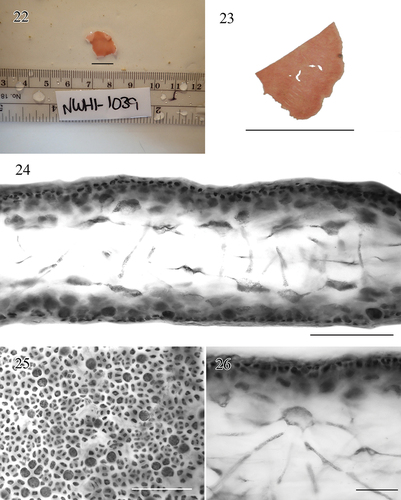Figs 22–26. Morphology and anatomy of Croisettea pakualapa sp. nov.Fig. 22. Live holotype specimen, BISH 780907. Scale bar = 1 cm.Fig. 23. Pressed voucher (visible cut from obtaining tissue for DNA extraction, BISH 780907 (holotype, tetrasporophyte). Scale bar = 1 cm.Fig. 24. Cross section through blade showing medullary filaments, BISH 780907. Scale bar = 50 μm.Fig. 25. Cortical cells and tetrasporangia in surface view, BISH 780907. Scale bar = 100 μm.Fig. 26. Detail of a stellate cell. BISH 780907. Scale bar = 50 μm.