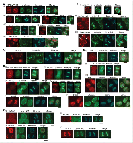 Figure 6. GAK-pY412, GAK-pY1149, ORC2, MCM2, and MCM3 translocate to chromatin at the end of telophase. (A–F) The subcellular localizations of GAK-pY412, GAK-pY1149, ORC2, MCM2, MCM3, and Lamin A/C during M phase are shown. Typical IF images are arranged along the time sequence of M phase progression. The yellow arrow (A-vi), white arrowheads (B-iii), green arrowheads (E-ii), and yellow arrowheads (F-ii) denote GAK-pY412 signals at interphase, GAK-pY1149 signals at the end of telophase, ORC2 signals at early anaphase, and the edge of the Lamin A/C envelope that was almost closed, respectively.