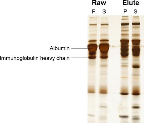 Figure S1 SDS-PAGE showing removal of the high abundant proteins, albumin and immunoglobulin heavy chain, from serum samples of patients with Parkinson’s disease (P) and schizophrenia (S).
