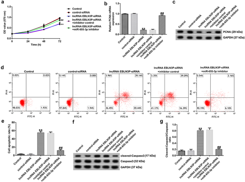 Figure 4. LncRNA EBLN3P knockdown inhibits the proliferation and induces apoptosis of Jurkat cells by upregulating miR-655-3p.