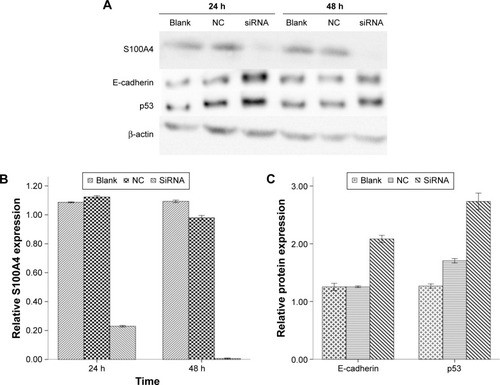 Figure 1 Analysis of S100A4, E-cadherin, and p53 after S100A4-siRNA treatment in A549 cell lines.