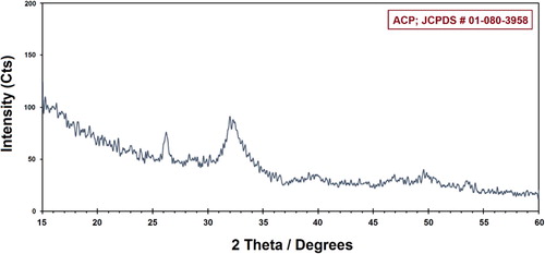 Figure 2. The XRD pattern of synthesized ACP-NPs.