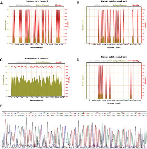 Figure 3 Blood mGNS gene sequence coverage depth map for PJ (A) and CMV (B); sputum mGNS gene sequence coverage depth map for PJ (C) and CMV (D). Multiple Mapping: Multiple comparing 2 or more species. Unique Mapping: unique comparison to a certain species. Identity: the identity of the sequence compared to the reference genome. The abscissa is the size and location of the genome; the ordinate on the left is the number of sequenced sequences of the reference genome; the ordinate on the right is the consistency of the sequenced sequence with the reference genome. Peak map of PJ nucleic acid by Sanger sequencing (E).