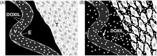 Figure 7. Schematic representation of effect of high-intensity focused ultrasound exposures on tumors in conjunction with intravenous injection of liposome-encapsulated doxorubicin (Doxil) as a model. (A) Region of tumor with intact endothelium (E) surrounding vessel (v) and densely packed tumor cells (T). (B) Same region as in A after high-intensity focused ultrasound exposure. It is hypothesized that focused ultrasound energy disrupts endothelial barriers and changes interstitial properties (alters vascular permeability and hydrostatic pressures in the parenchyma), enhancing extravasation and distribution of pharmaceutical agents. (Citation[62] Reprinted with permission.)