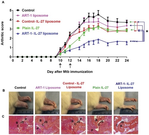 Figure 4 Arthritis treatment with ART-1-IL-27 liposomes. A Lewis rats arthritis model was used to i.v. administer free IL-27, ART-1-IL-27 liposomes, control-IL-27 liposomes, or ART-1 liposomes and an untreated PBS control. (A) The differences in arthritic scores of the 4 pairs of groups were signiﬁcant (*P<0.01): ART-1-IL-27 liposomes v/s control rats, ART-1-IL-27 liposomes v/s ART-1 liposomes without IL-27, ART-1-IL-27 liposomes v/s control-IL-27 liposomes, and ART-1-IL-27 liposomes v/s free IL-27. (B) Photographs of the rat’s hind paw at the end of the treatment and (C) H&E-staining of hind paw sections, the histopathological features represented as: B: bone, C: cartilage, JS: joint space, P: pannus. Reprinted with permission from Elsevier, JControlled Release, Peptide-directed liposomal delivery improves the therapeutic index of an immunomodulatory cytokine in controlling autoimmune arthritis, Meka RR, Venkatesha SH, Moudgil KD. Copyright 2018.Citation168