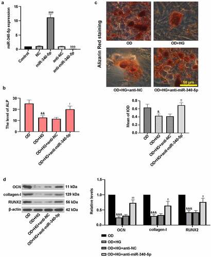 Figure 3. Down-regulation of miR-340-5p promoted osteogenic differentiation in MC3T3-E1 cells. (a) Cells were infected with lentivirus-based miR-340-5p inhibitor (anti-miR-340-5p), pre-mir-340 (miR-340-5p) or their negative controls (anti-NC and NC) for 72 h. Subsequently, osteoblast differentiation was induced, and cells were treated with HG for 14 days. (b) ALP activity was measured with the kit. (c) Treated cells were stained with Alizarin Red and quantified accordingly. Scale bar = 50 μm. (d) OCN, collagen-I, and RUNX2 protein levels were assessed with immunoblotting. NC, negative control. Data were expressed as means ± SD (N = 3 per group). aaaP < 0.001 versus NC group; bbbP < 0.001 versus anti-NC group; &P < 0.05 and &&P < 0.01 versus OD group; !P < 0.05, !!P < 0.01 and !!!P < 0.001 versus OD+HG+anti-NC group