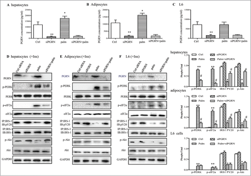 Figure 6. Involvements of PGRN in palmitate (palm)-induced IR in vitro. Control cells and PGRN-/- cells were pre-incubated with 0.5 mM palmitate for 16 h prior to incubation with 10 nM insulin (Ins) for 10 min. (A–C) PGRN content in culture media of cells with or without palmitate treatment. (D) The phosphorylation of IRS-1, Akt, PERK, and eIF2α in hepatocytes. (E) The phosphorylation of IRS-1, Akt, PERK, and eIF2α in adipocytes. (F) The phosphorylation of IRS-1, Akt, PERK, and eIF2α in L6 cells. The right is the quantification of proteins phosphorylation with normalization to total protein levels for each molecule under this condition. A representative blot is shown and all graphs show means ± SEM from at least 3 independent experiments. *P < 0.05, **P < 0.01 vs. the control groups. #P < 0.05 vs. the palmitate-treated groups.