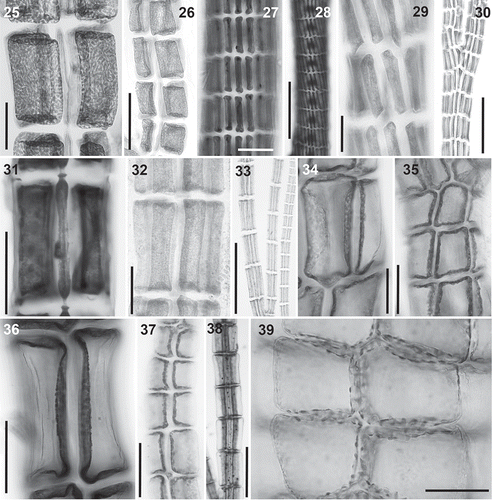 Figs 25–39. Plastid arrangement in the Polysiphonieae. Scattered against all cell walls of the pericentral cells in Polysiphonia stricta (Figs 25–26, Polysiphonia sensu stricto clade 1), Vertebrata lanosa (Figs 27–28, Vertebrata clade), P. virgata (Figs 29–30, Carradoriella clade), Polysiphonia sp. (Fig. 31, Streblocladia clade) and P. schneideri (Figs 32–33, ‘P.’ schneideri clade). Lying exclusively on the radial walls of the pericentral cells in species of the Melanothamnus clade: Neosiphonia collabens (Figs 34–35), N. harveyi (Figs 36–38) and P. forfex (Fig. 39). Scale bars: Figs 25, 27, 29, 38 and 39, 500 µm; Figs 26, 28 and 30, 800 µm; Figs 31, 32, 34, 35 and 37, 100 µm; Fig. 33, 300 µm; Fig. 36, 50 µm.